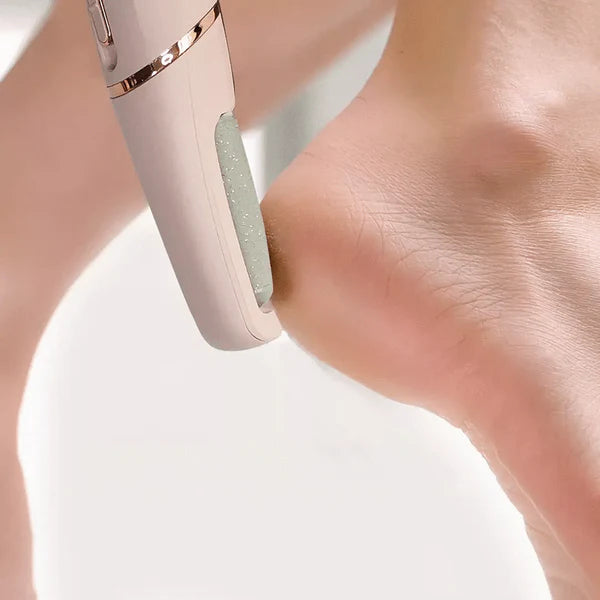 Klevinte™ - The Foot Callus Remover