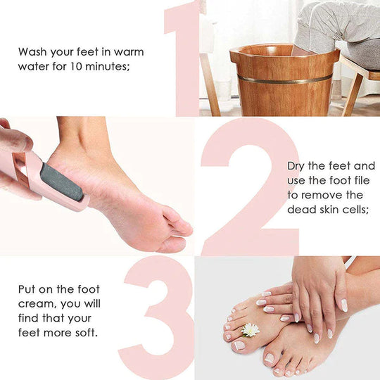 Klevinte™ - The Foot Callus Remover